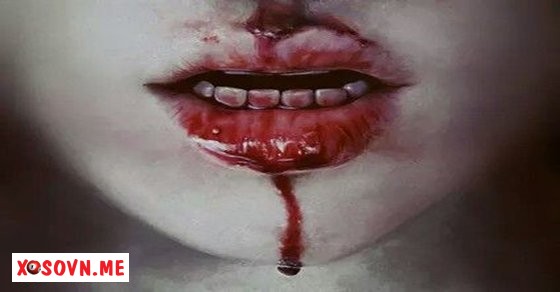 Mơ thấy máu chảy nhiều